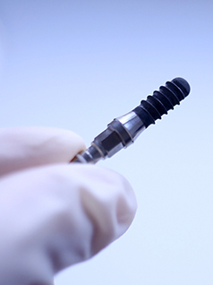 Dental Implant