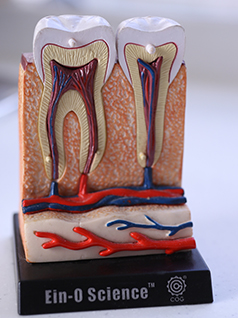 Root Canal Treatment